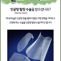 모르면 나만 손해보는 인공망 탈장(Hernia mesh)수술!